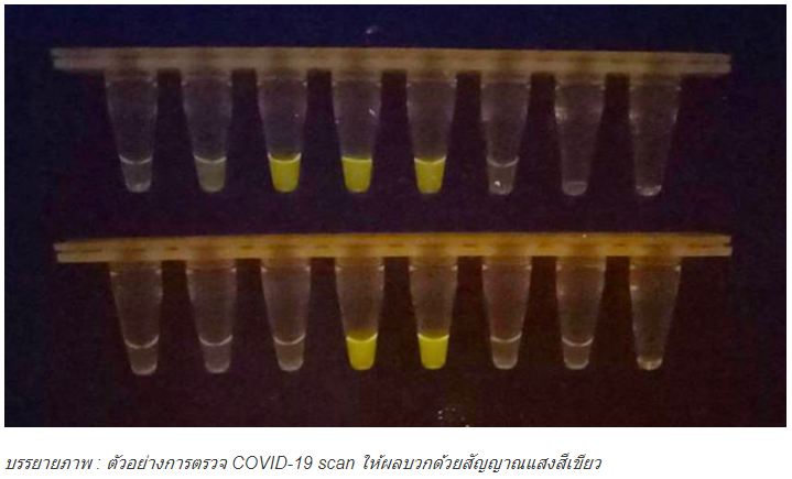 ตัวอย่างชุดตรวจโควิด